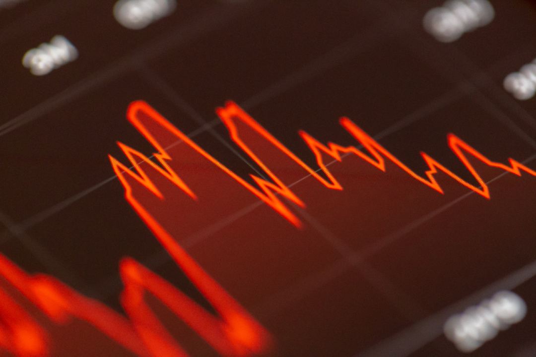 어두운 화면 위로 붉게 오르내리는 주가 그래프(상징 사진)